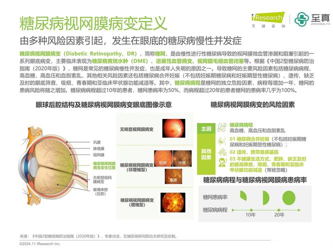 眼科领域未来发展前景如何?